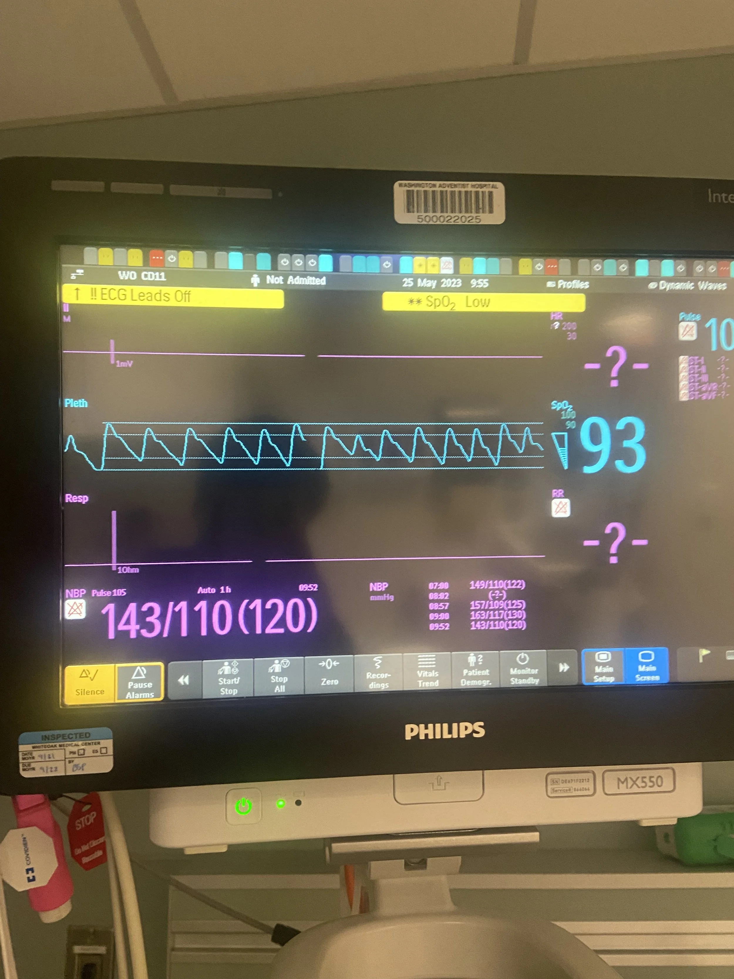 Medical monitor display showing vital signs.