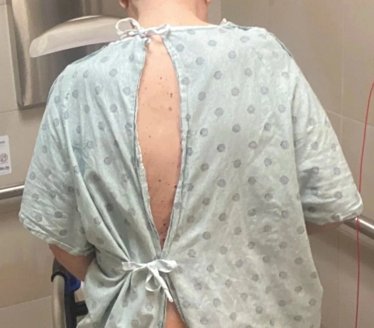 Person in a hospital gown sitting with their back facing the camera.