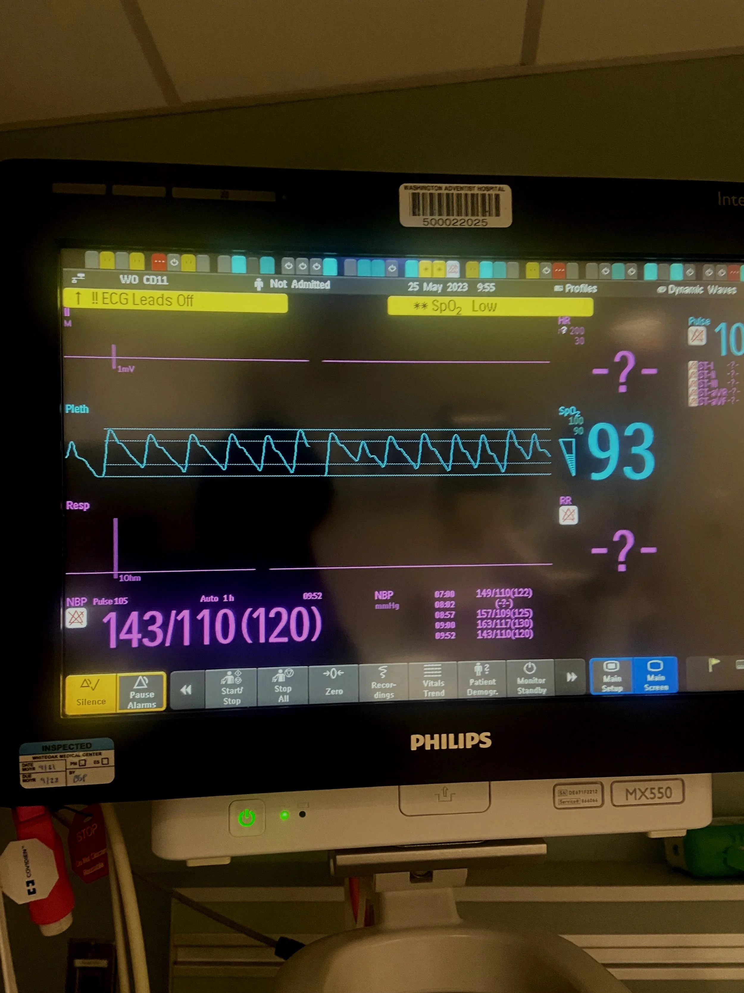 Medical monitor display showing vital signs.