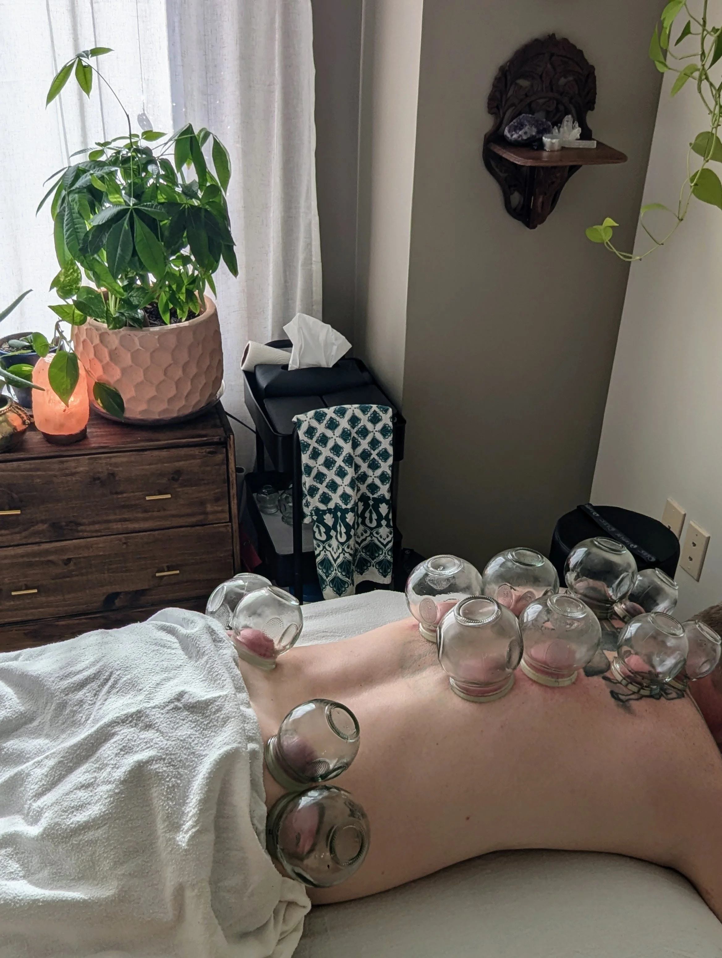 Cupping.jpg