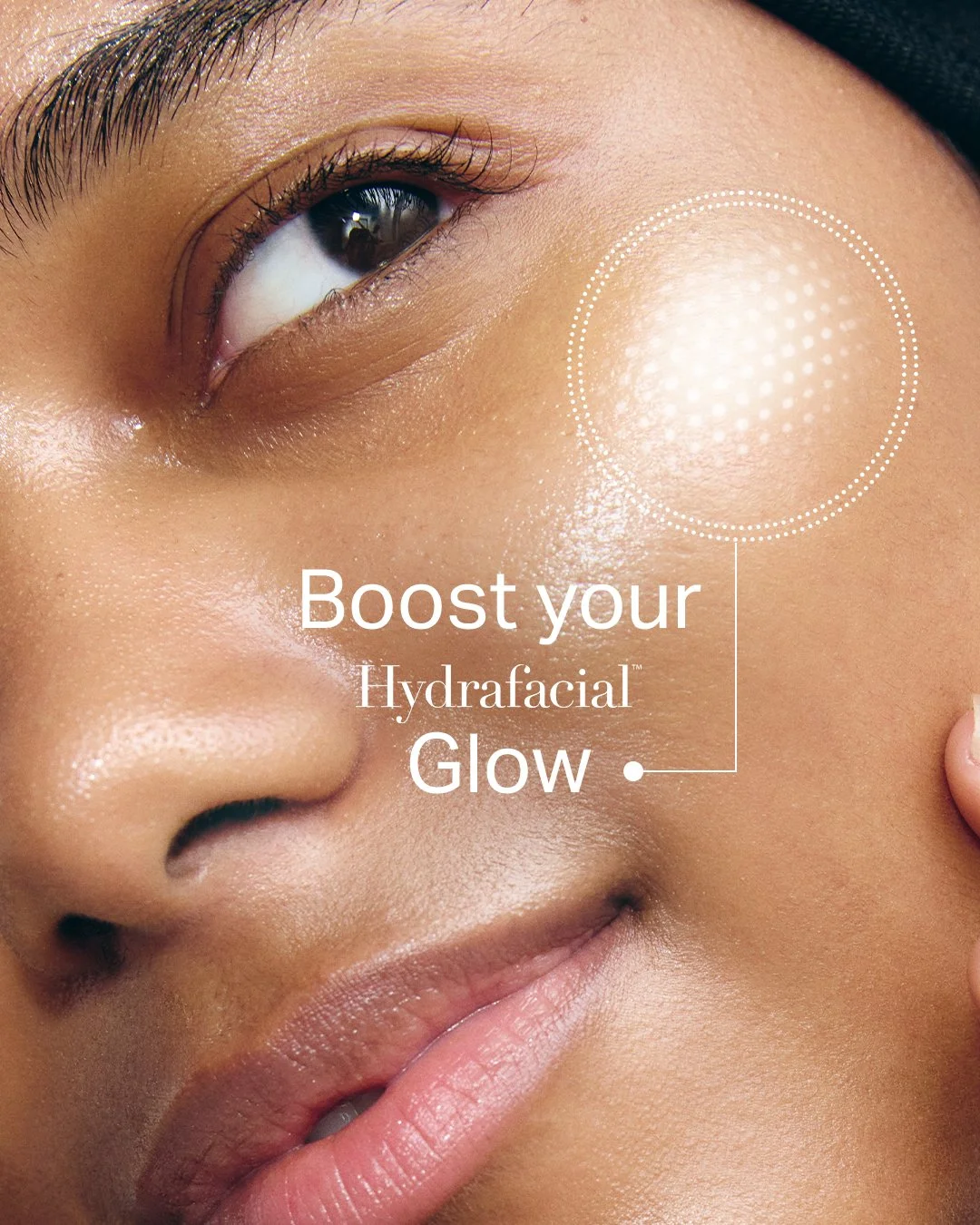 Deluxe Hydrafacial Series ( 3 Treatments)