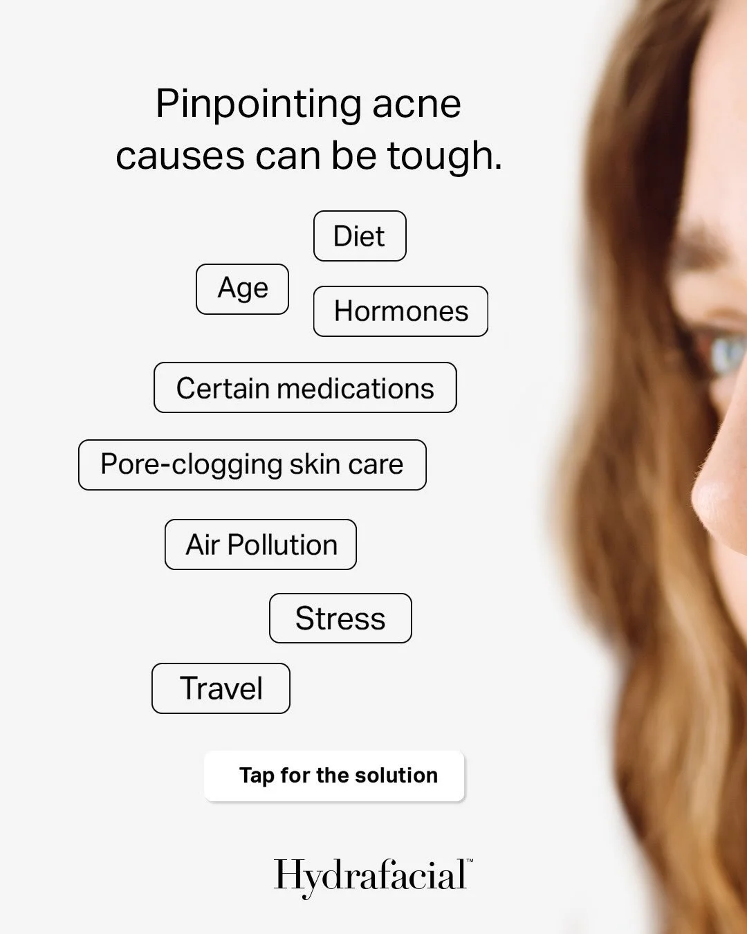 Acne can be difficult to pinpoint and treat because there are often multiple factors involved.

Hydrafacial is a great option for acne-prone and oily skin, helping to deeply cleanse and exfoliate while removing buildup, excess oil, and impurities fro