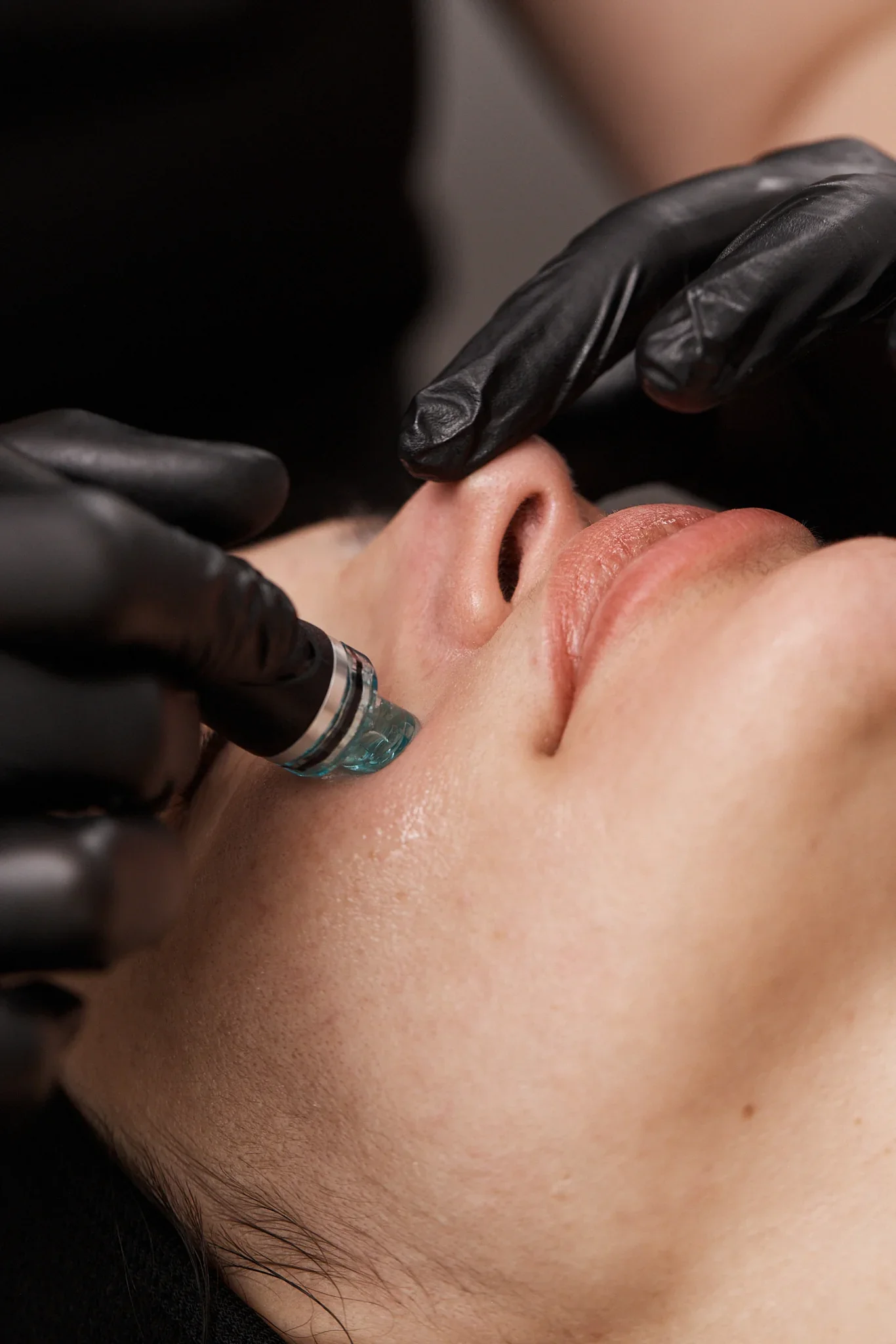 Deluxe Hydrafacial