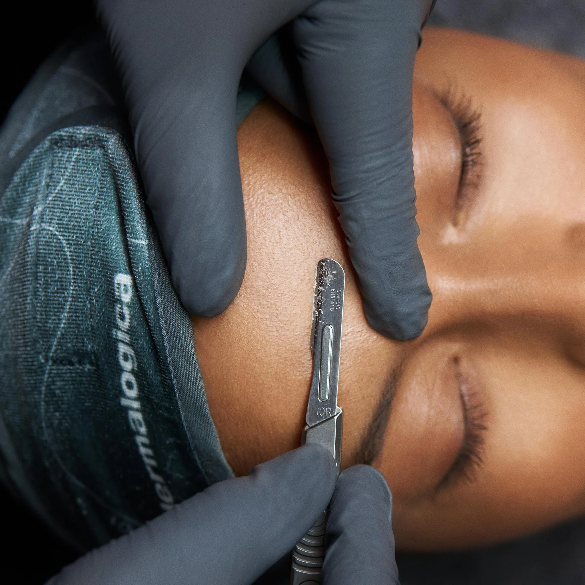 Dermaplane (Add-On)