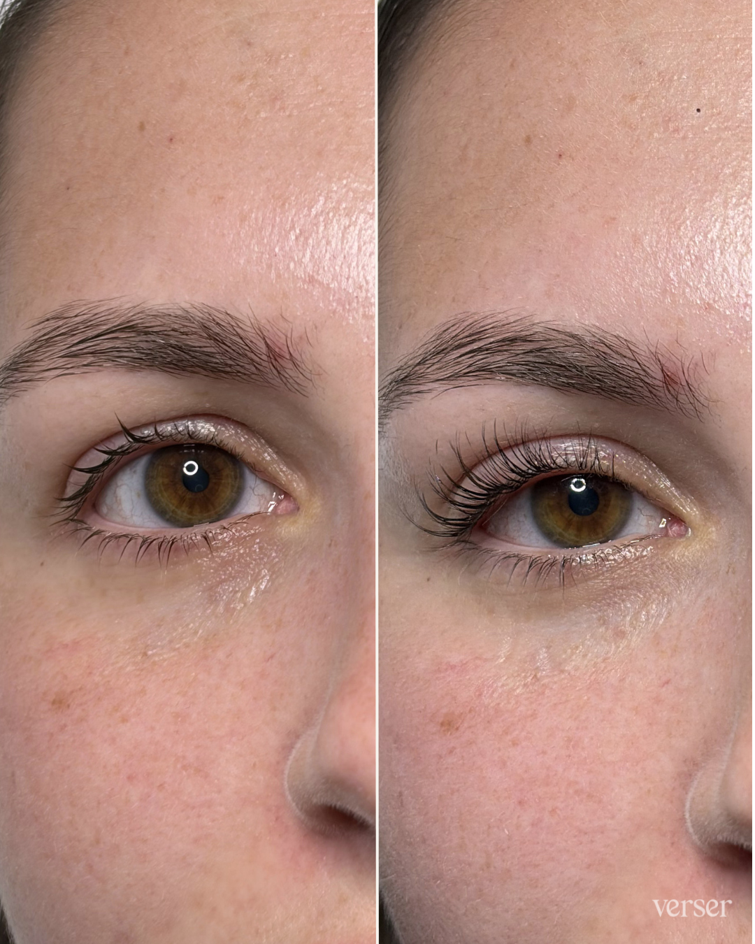 Close-up of a woman's face showing a before and after comparison of her eye with eyelash extensions or enhancements, highlighting longer, darker lashes.