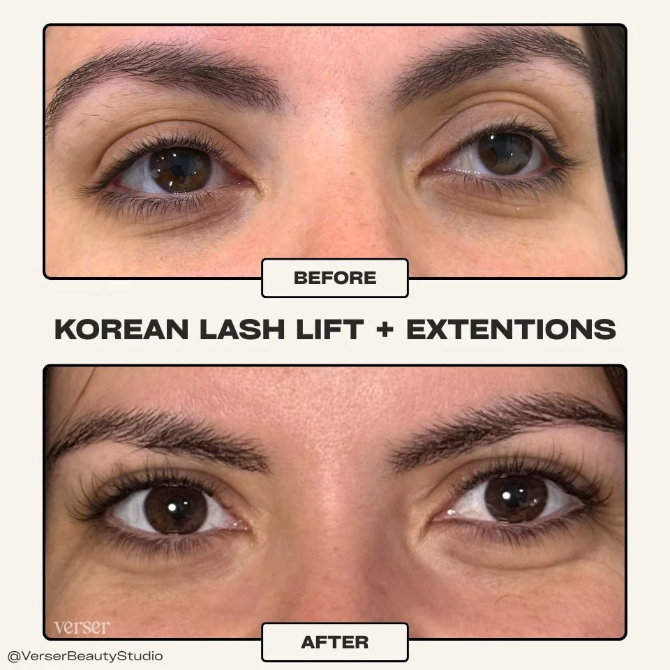 Before and after of eyes looking more awake and lashes longer looking after Korean lash lift and extensions combination
