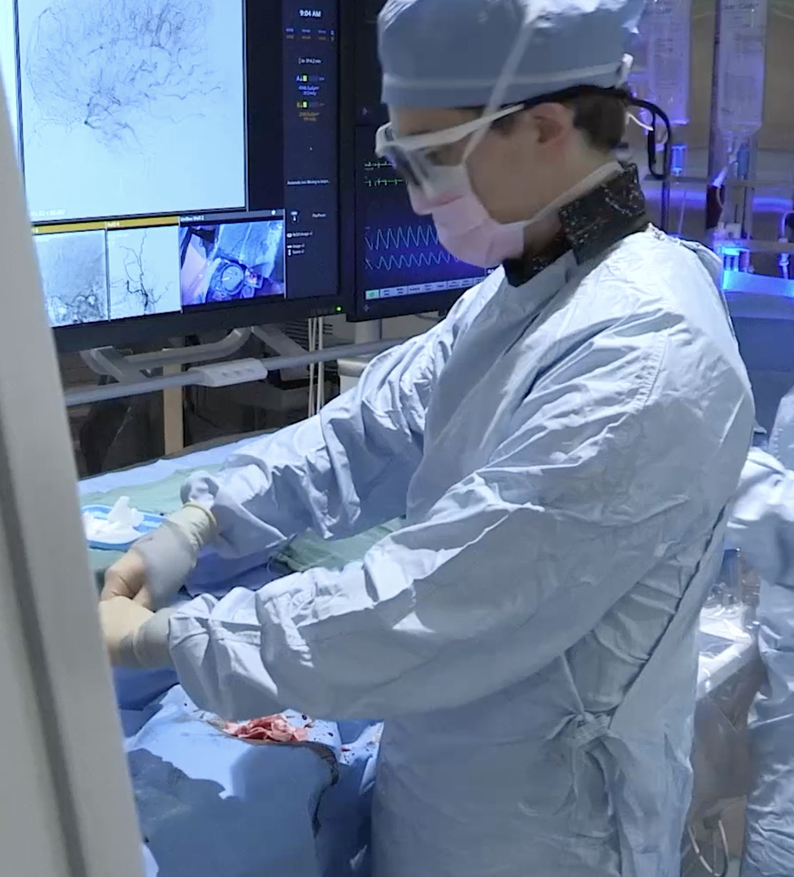 Endovascular neurosurgeon performing a catheter-based procedure in the angiography suite