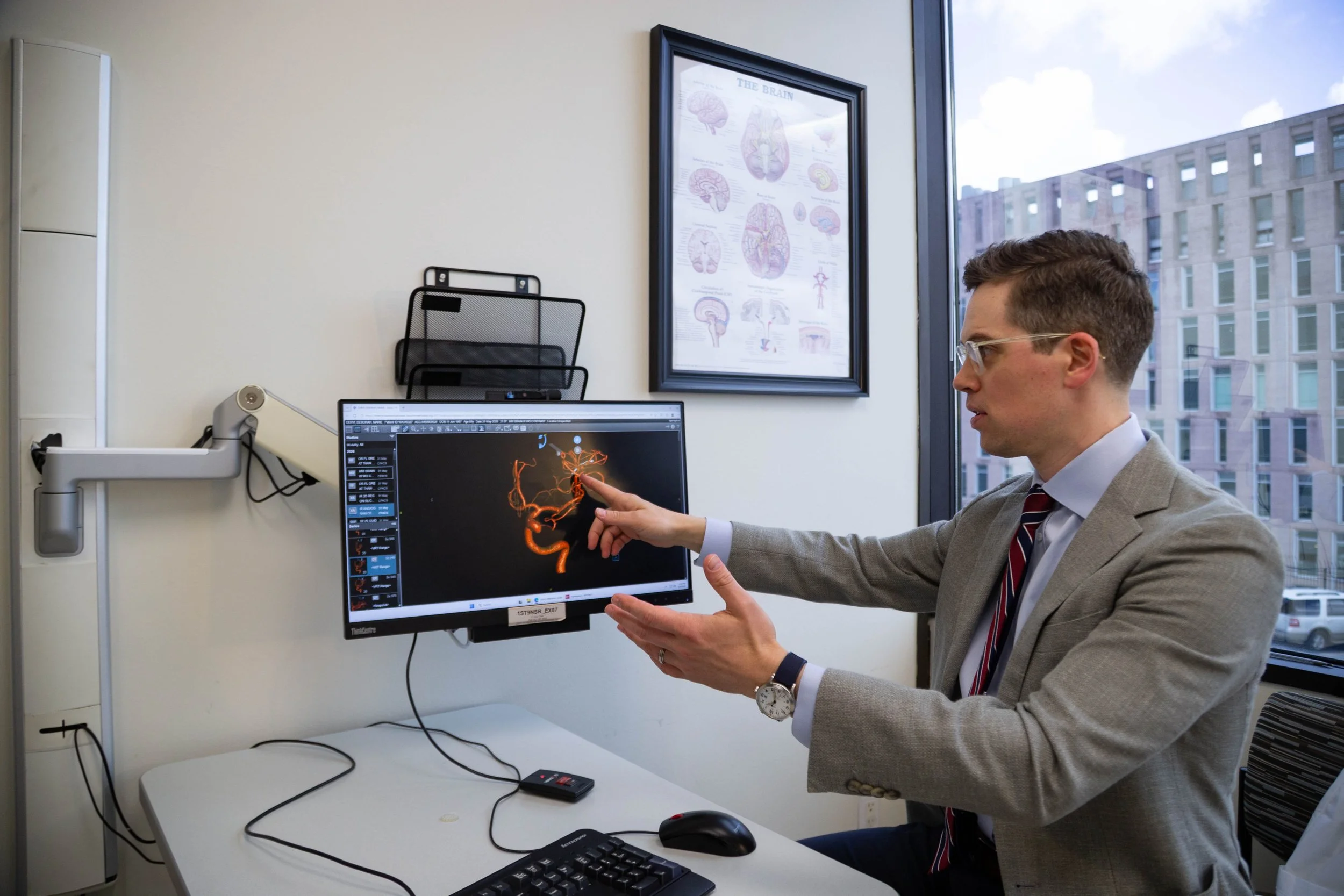 Dr. Kurt Yaeger reviewing a 3D model of brain blood vessels
