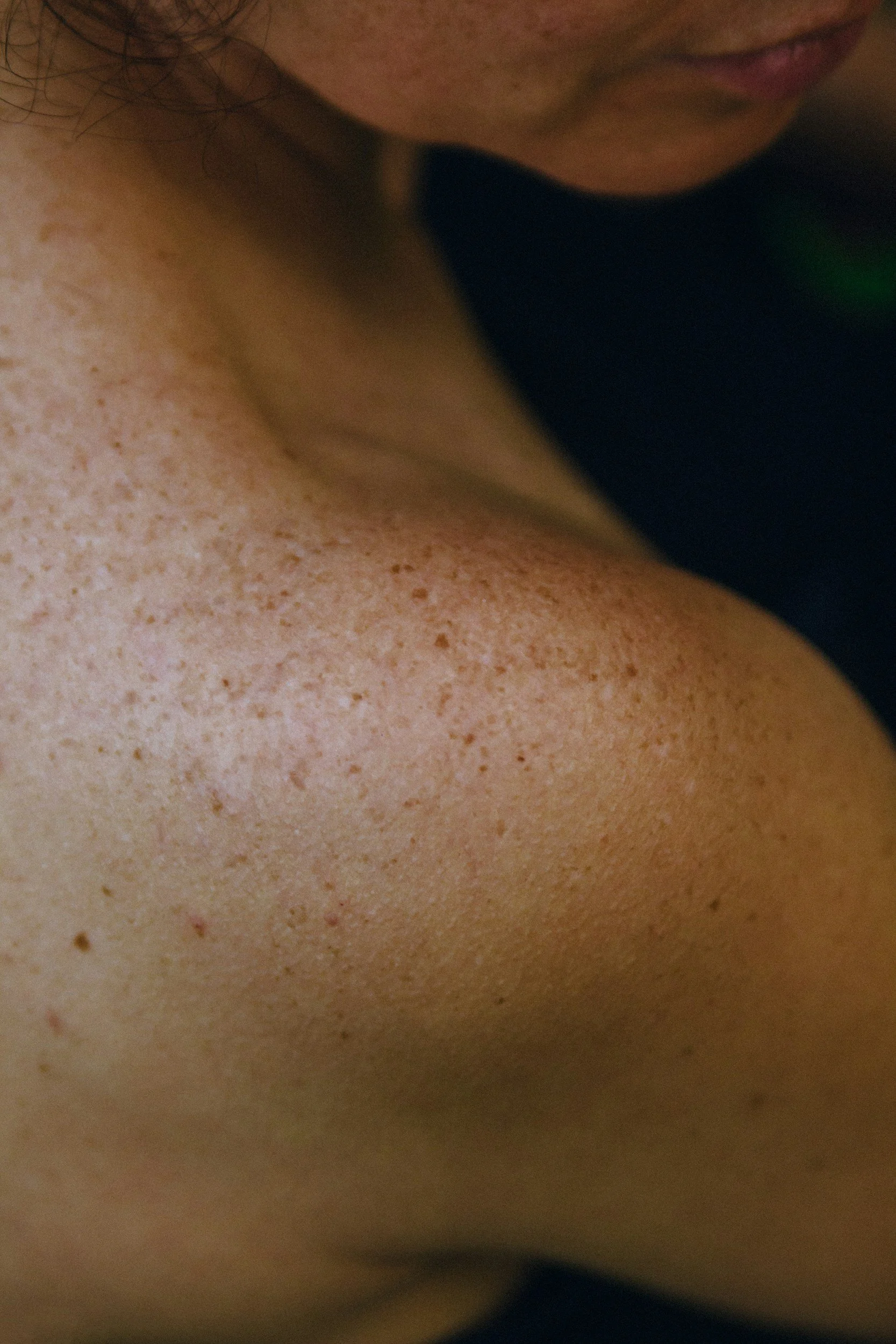 Nahaufnahme von der Haut mit Sommersprossen und Lippen.