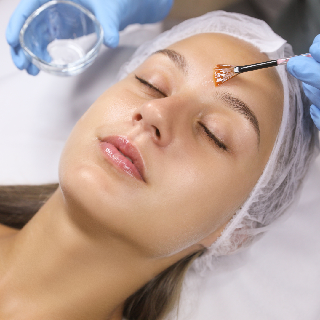 Medspa in Orange, CA 92868 l Peels Near Me