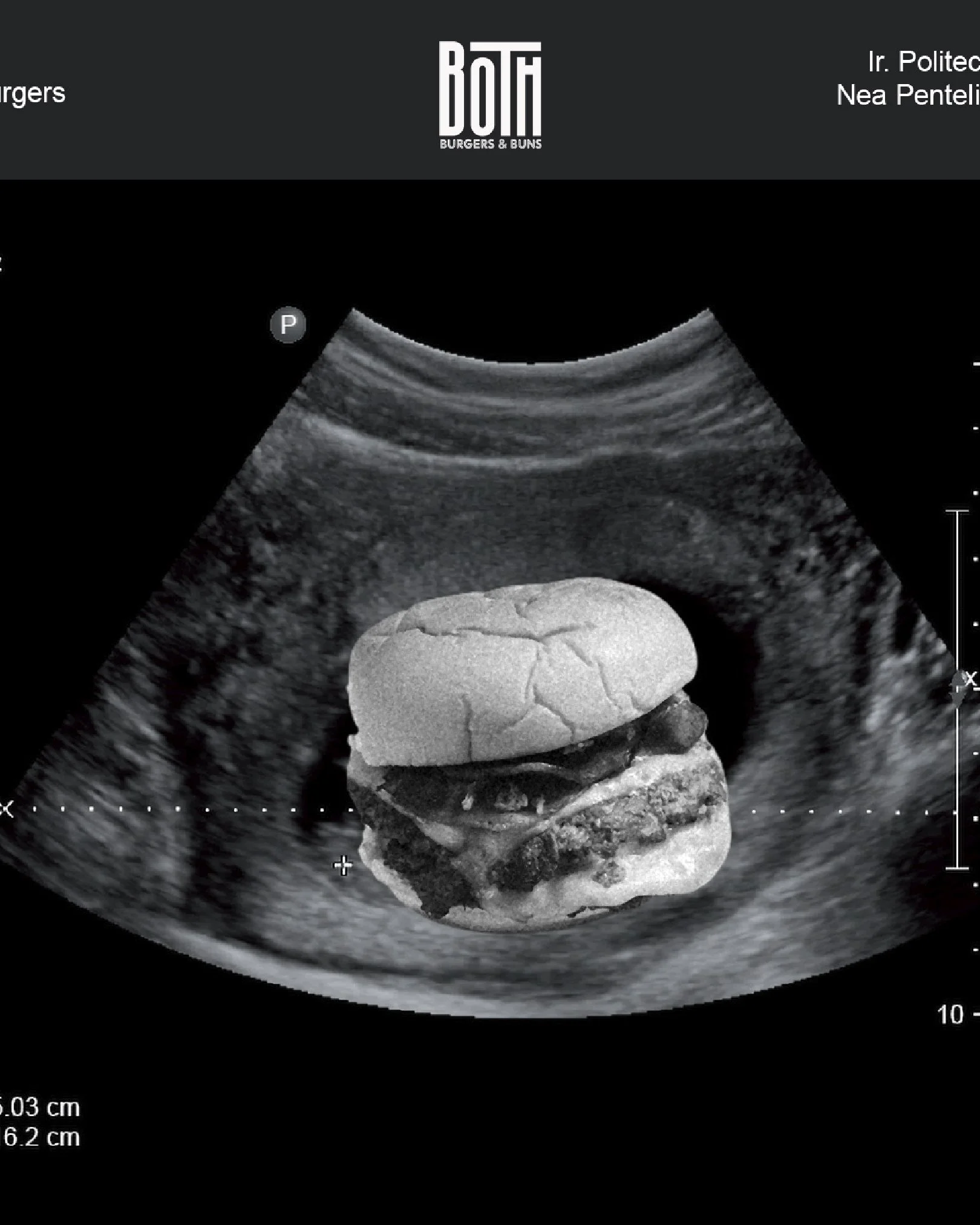 august_ultrasound.jpg