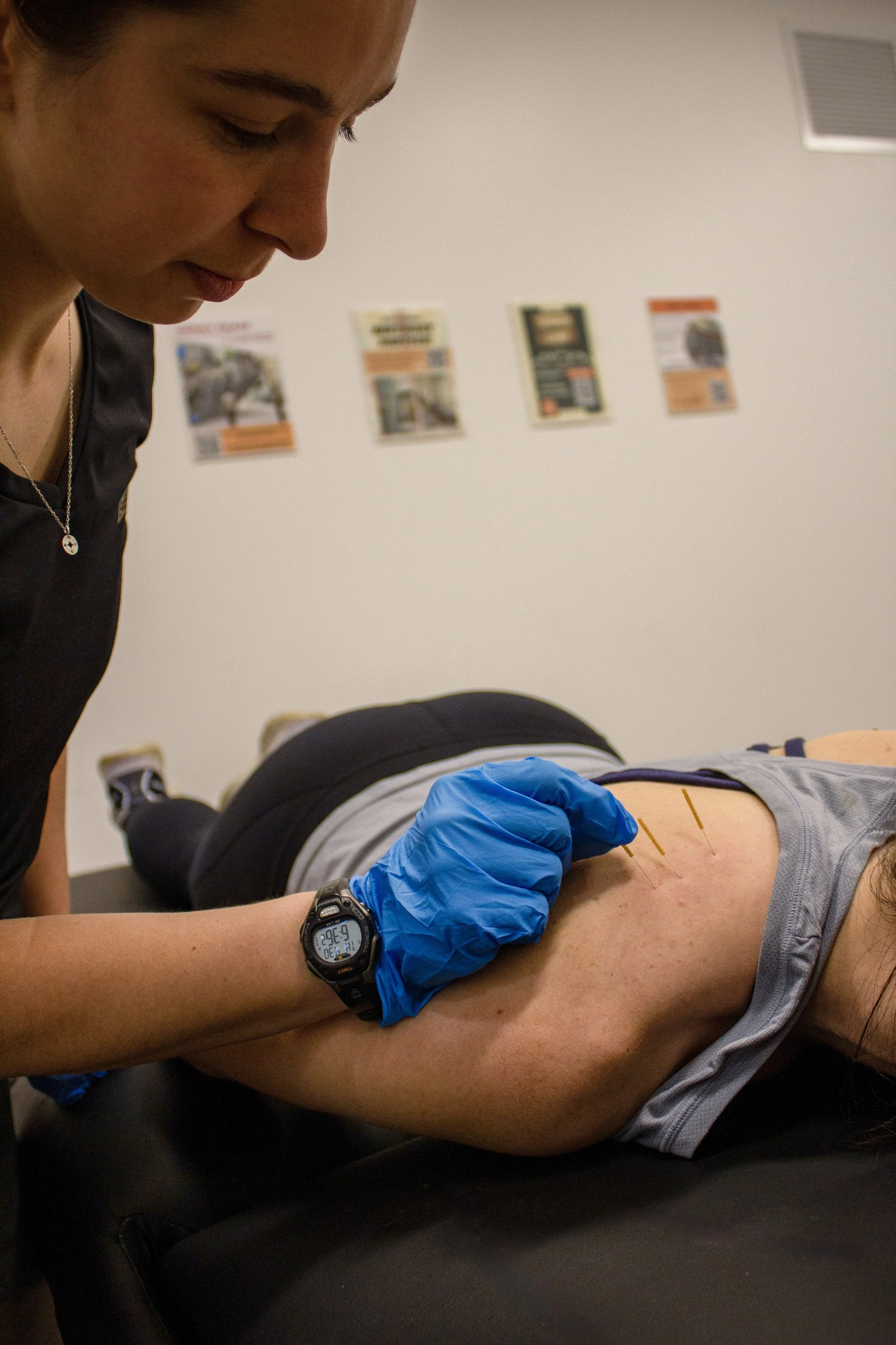 Physical therapist performs dry needling on patient's shoulder