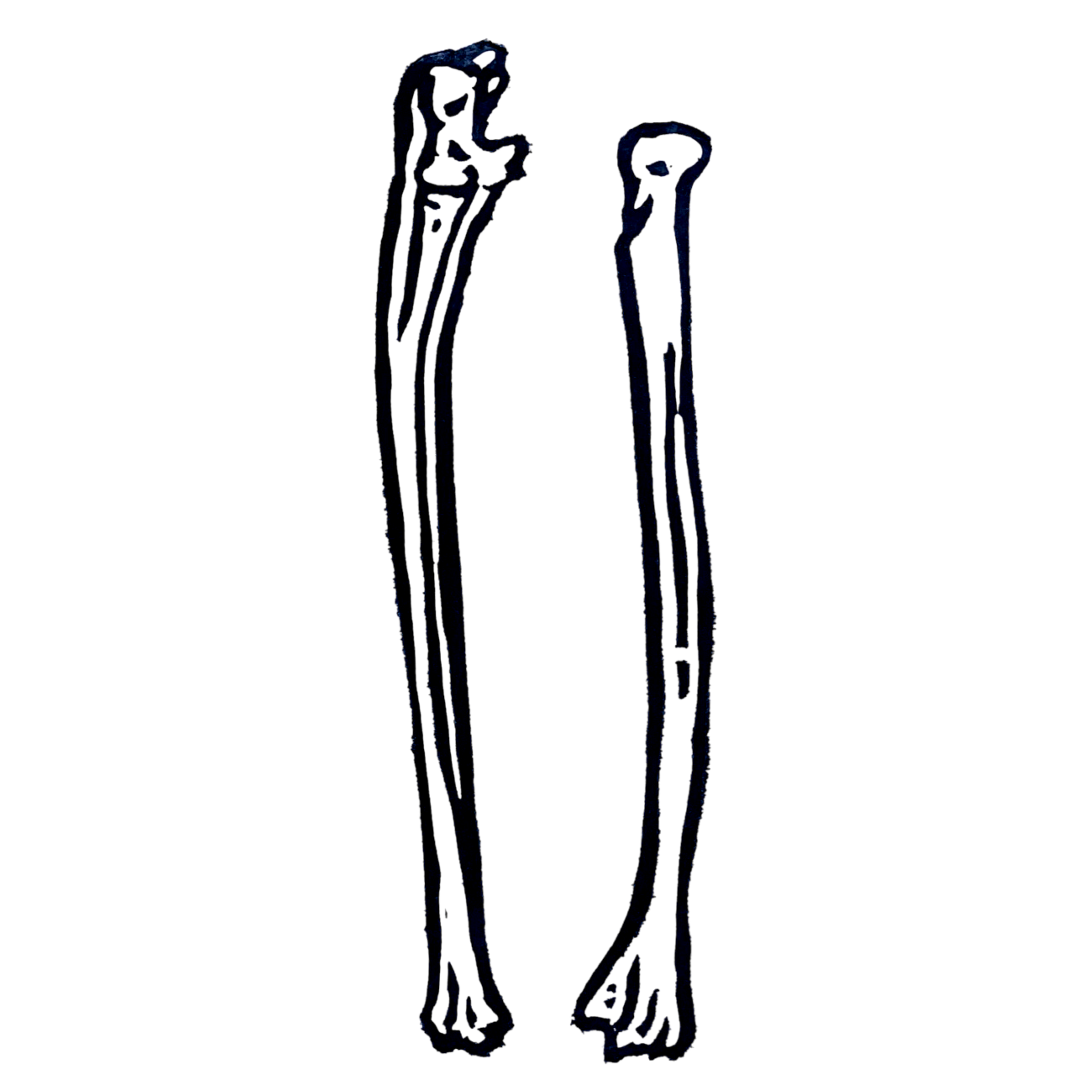 Human Radius & Ulna