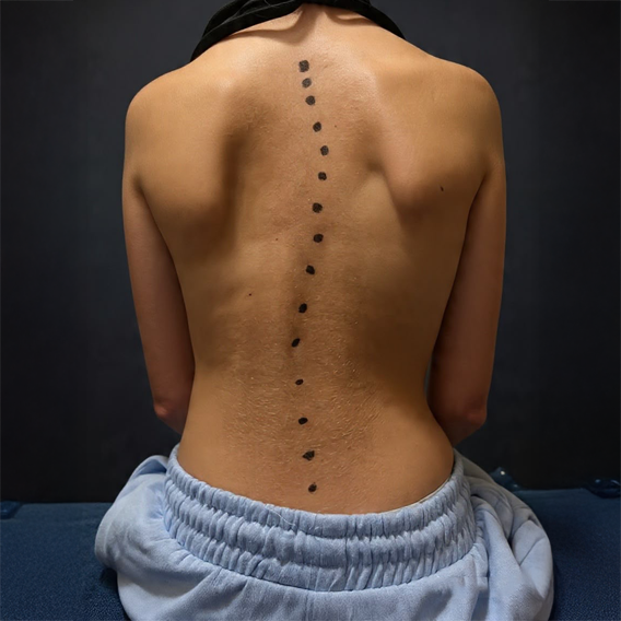 Scoliosis Department