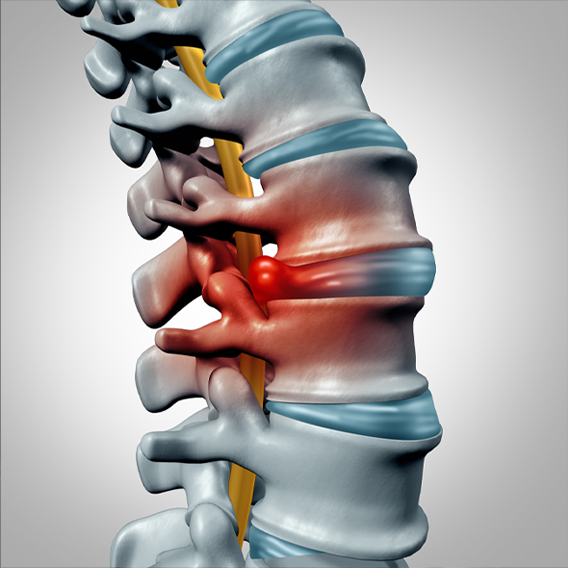 Spine Care Department