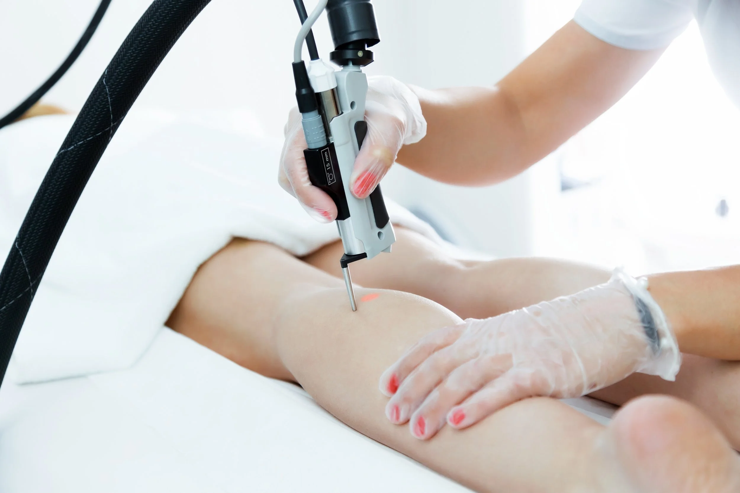 Cynosure laser hair removal uses advanced, medical-grade dual-wavelength lasers (Alexandrite and Nd:YAG) to target hair follicles. It is highly effective for permanent hair reduction across all skin tones.