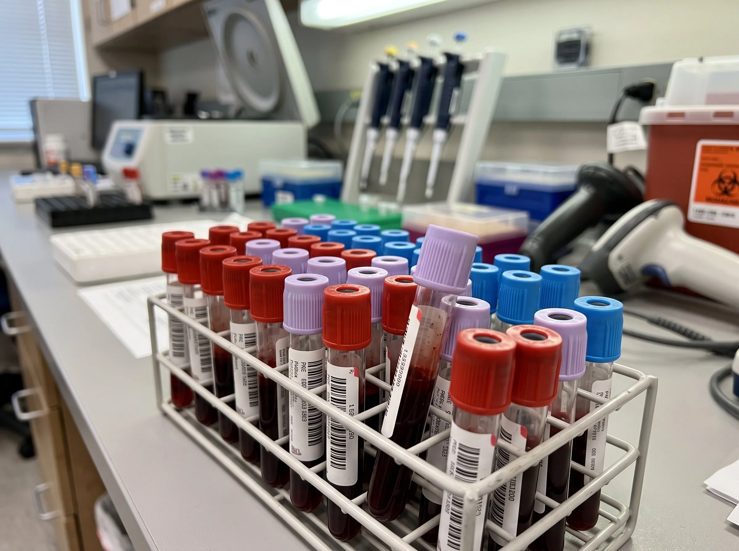 Multiple blood collection tubes with red and purple caps in a white rack on a laboratory counter. Various lab equipment is in the background.