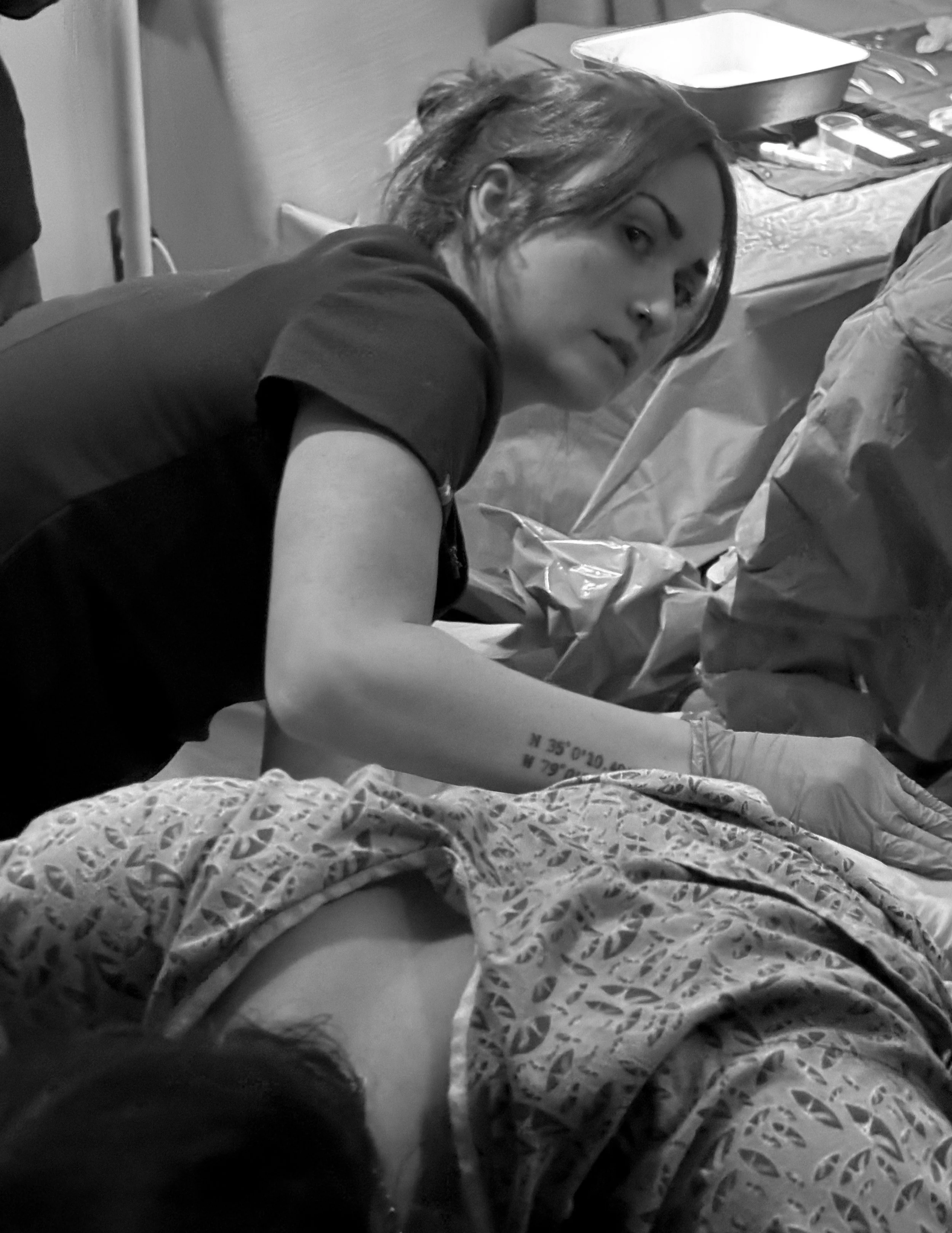 A young woman with dark hair and eyebrows, with a piercing in her nose, lies in a hospital bed wearing a hospital gown with a geometric pattern. She looks over her shoulder, and her arm is visible.