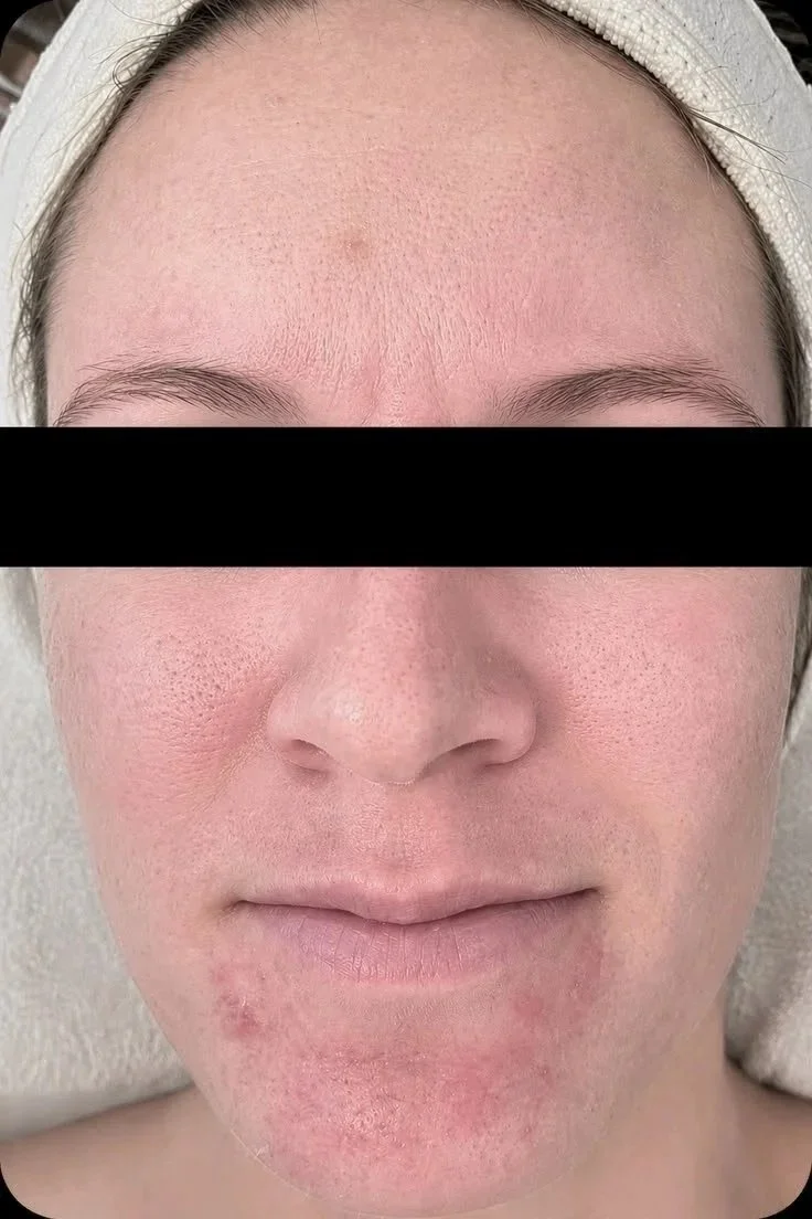 Angenette+Before+1.jpg