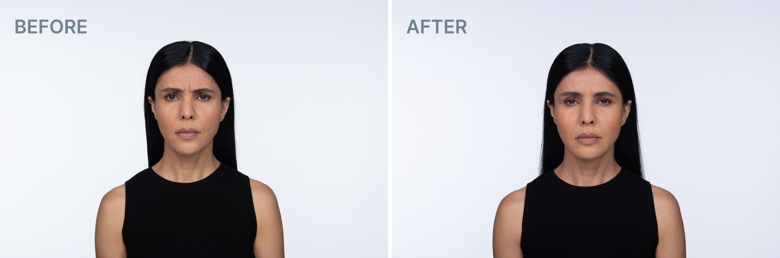 Before and after 4