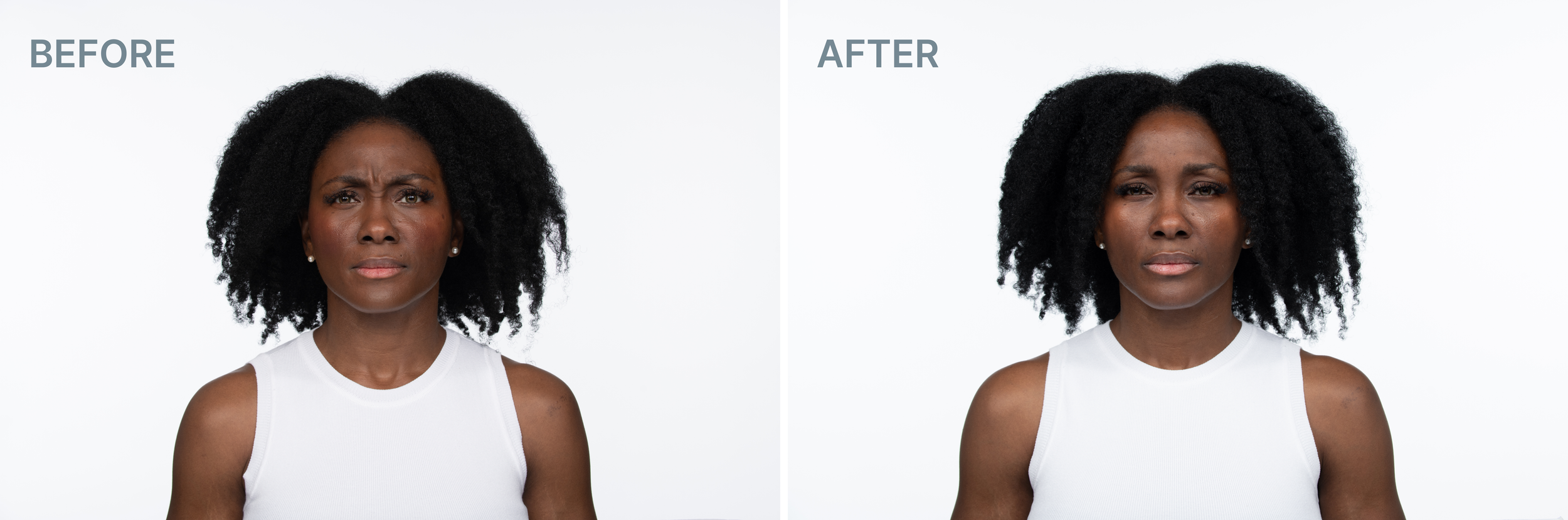 Before and after 1