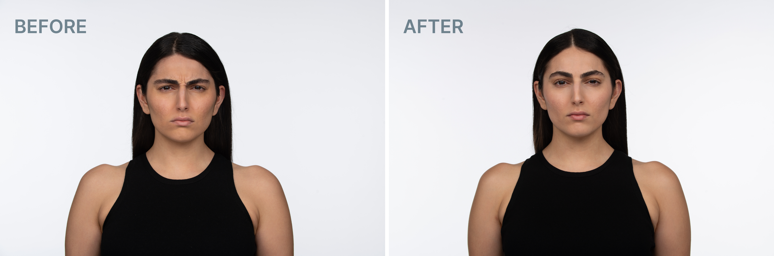 Before and after 2