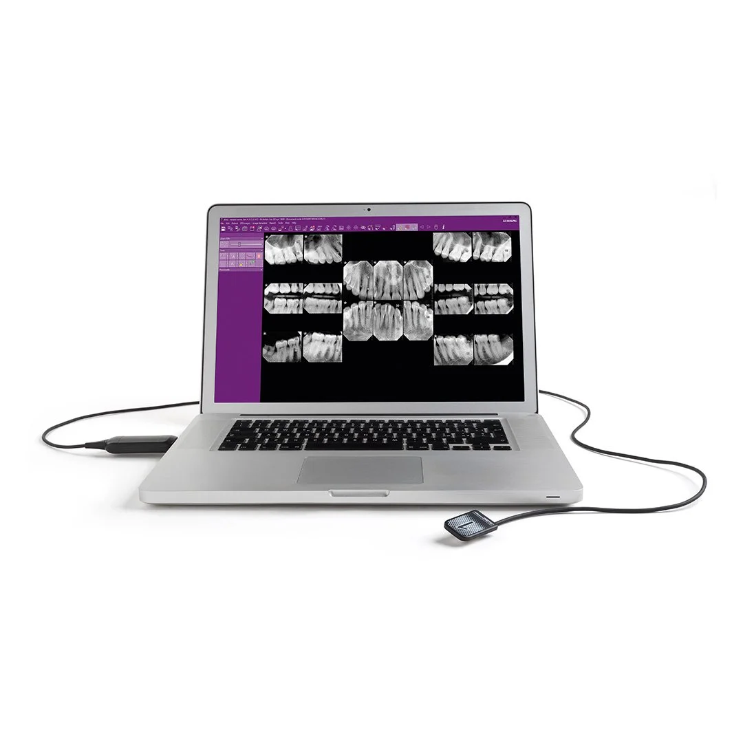 Laptop displaying dental X-ray images on screen with a digital scanner connected.