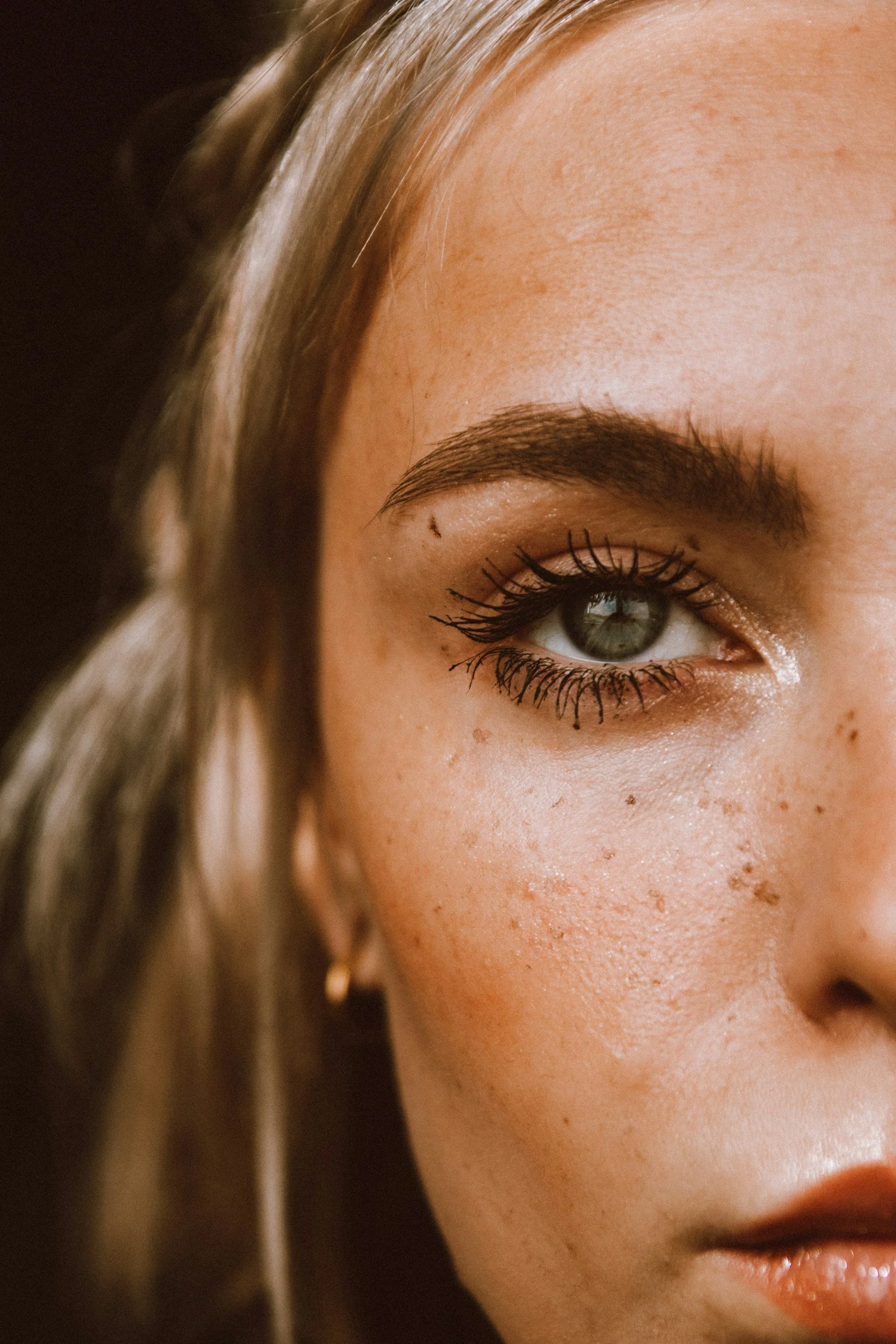Close-up of a woman with glowing skin after skin blemish removal