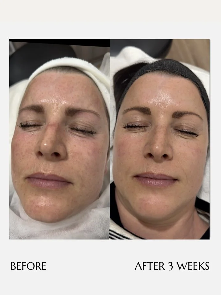 Before and after treatment photo