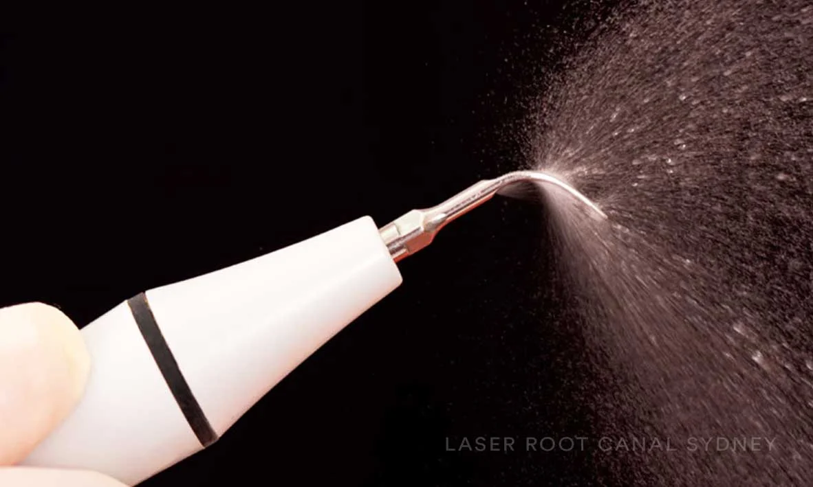 © Laser Root Canal Sydney Detnal Hygiene Deep Cleaning Gums.jpg