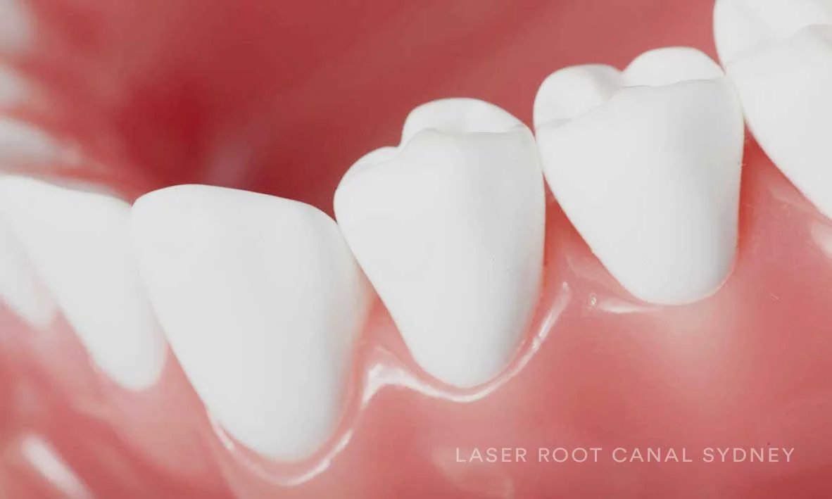 © Laser Root Canal Sydney Denture.jpg
