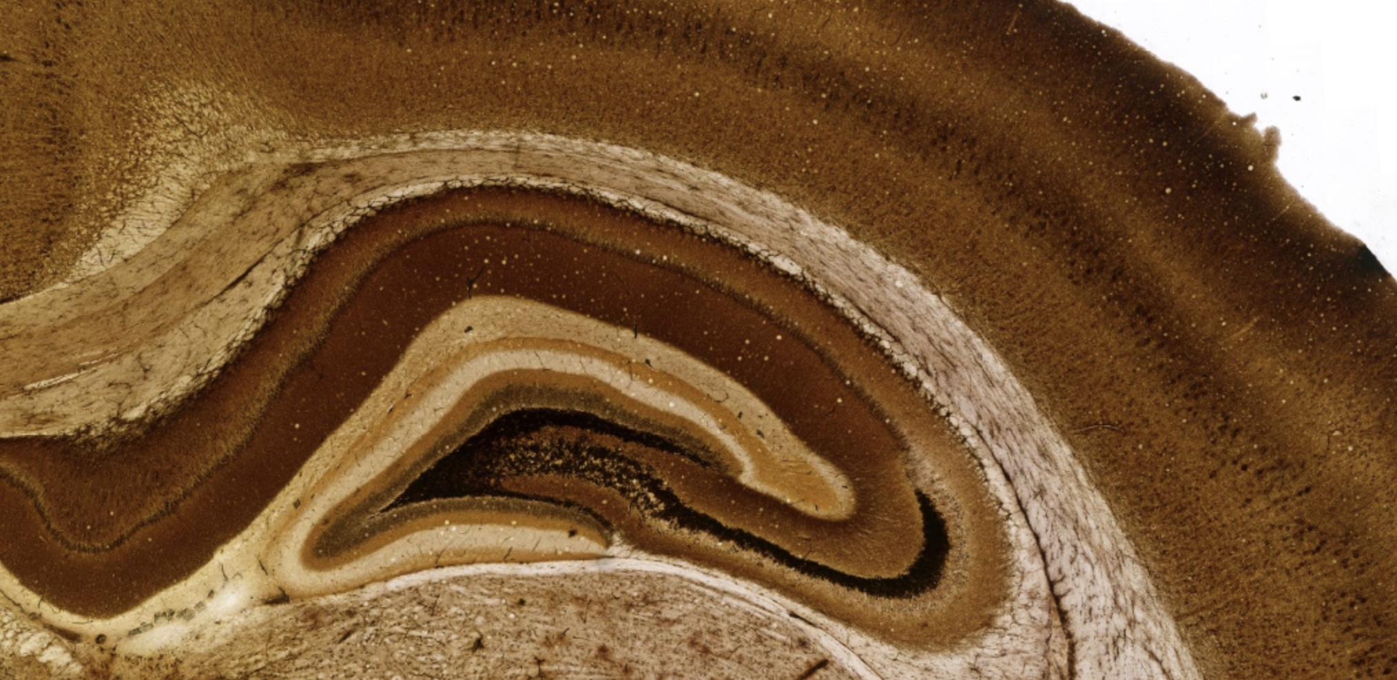 Finding gold in silver-stained rat brains