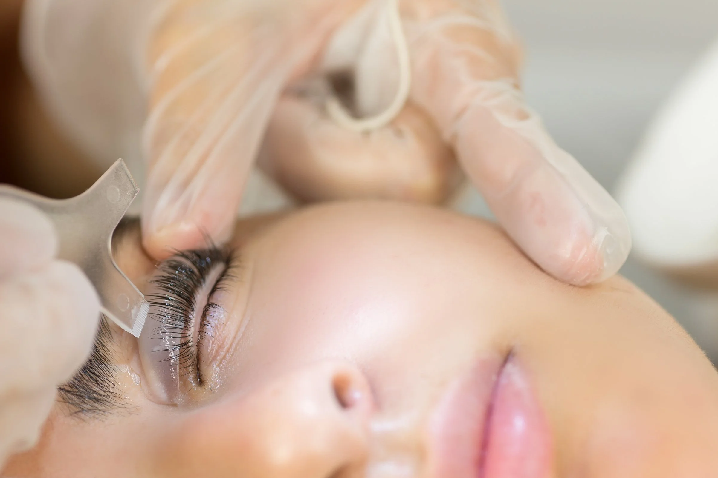 Close-up of a person receiving an eyelash extension procedure, with the technician wearing gloves and using tools to attach false eyelashes to natural lashes.
