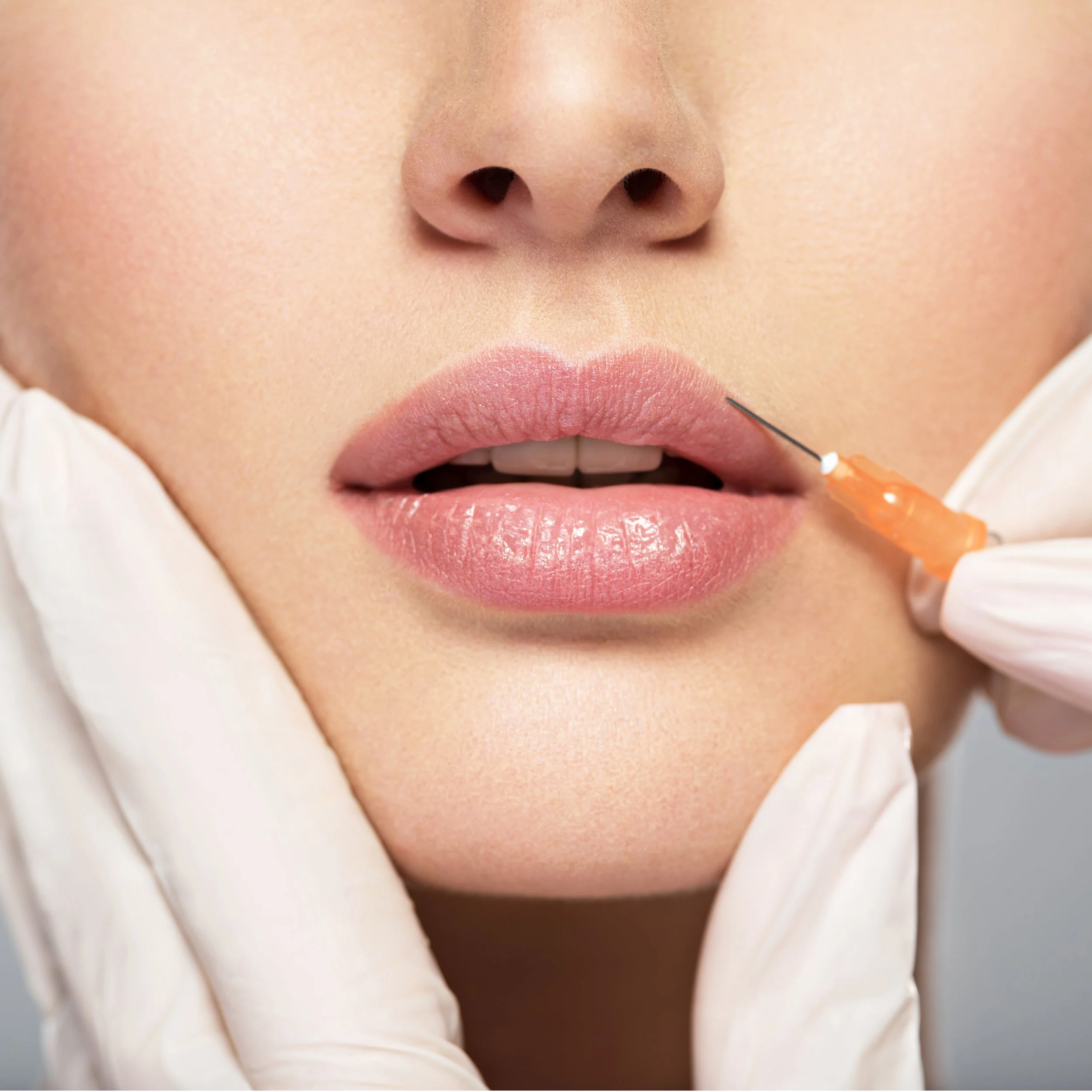 Close-up of a person's lips and nose, with a syringe near the lower lip indicating a cosmetic or medical procedure.