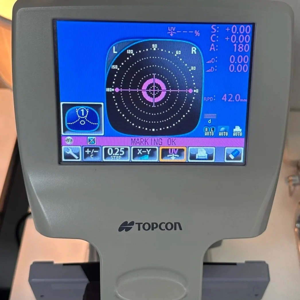 A dental or medical scanning device with a colorful digital display showing a circular target pattern, various measurements, and settings. The device is branded 'TOPCON'.