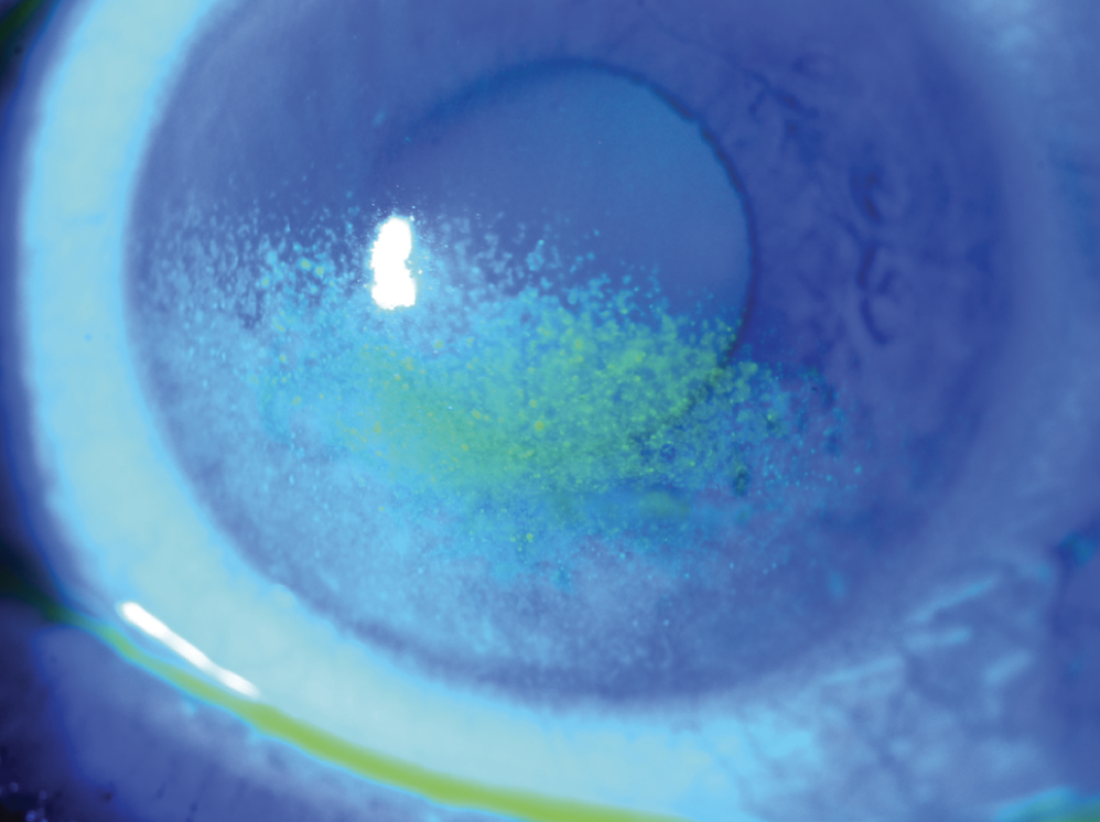 Close-up of an eye's cornea, showing blue and green tones with a reflection of light.