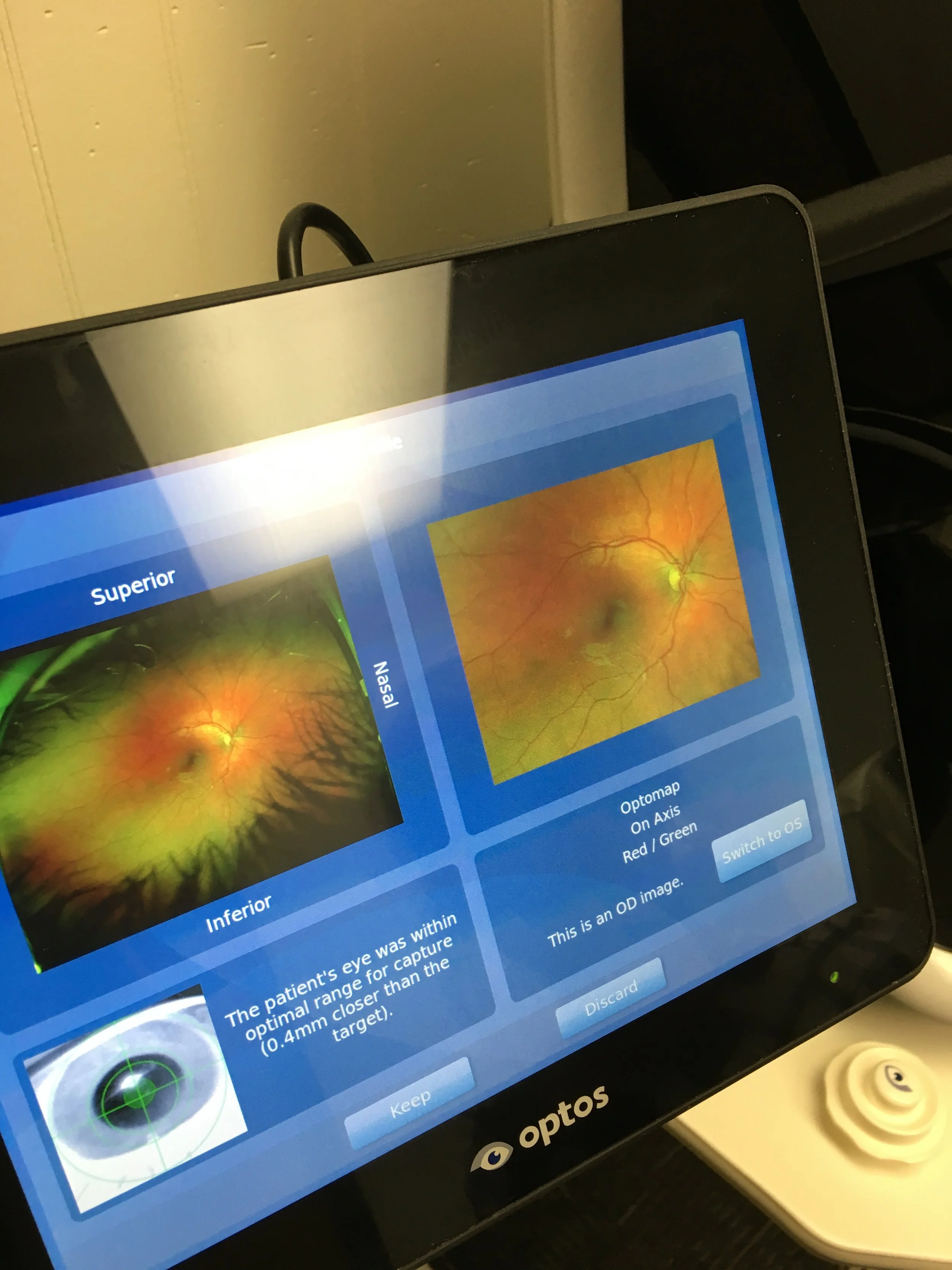Close-up image of an ophthalmic device screen displaying retina scan images and related medical information.
