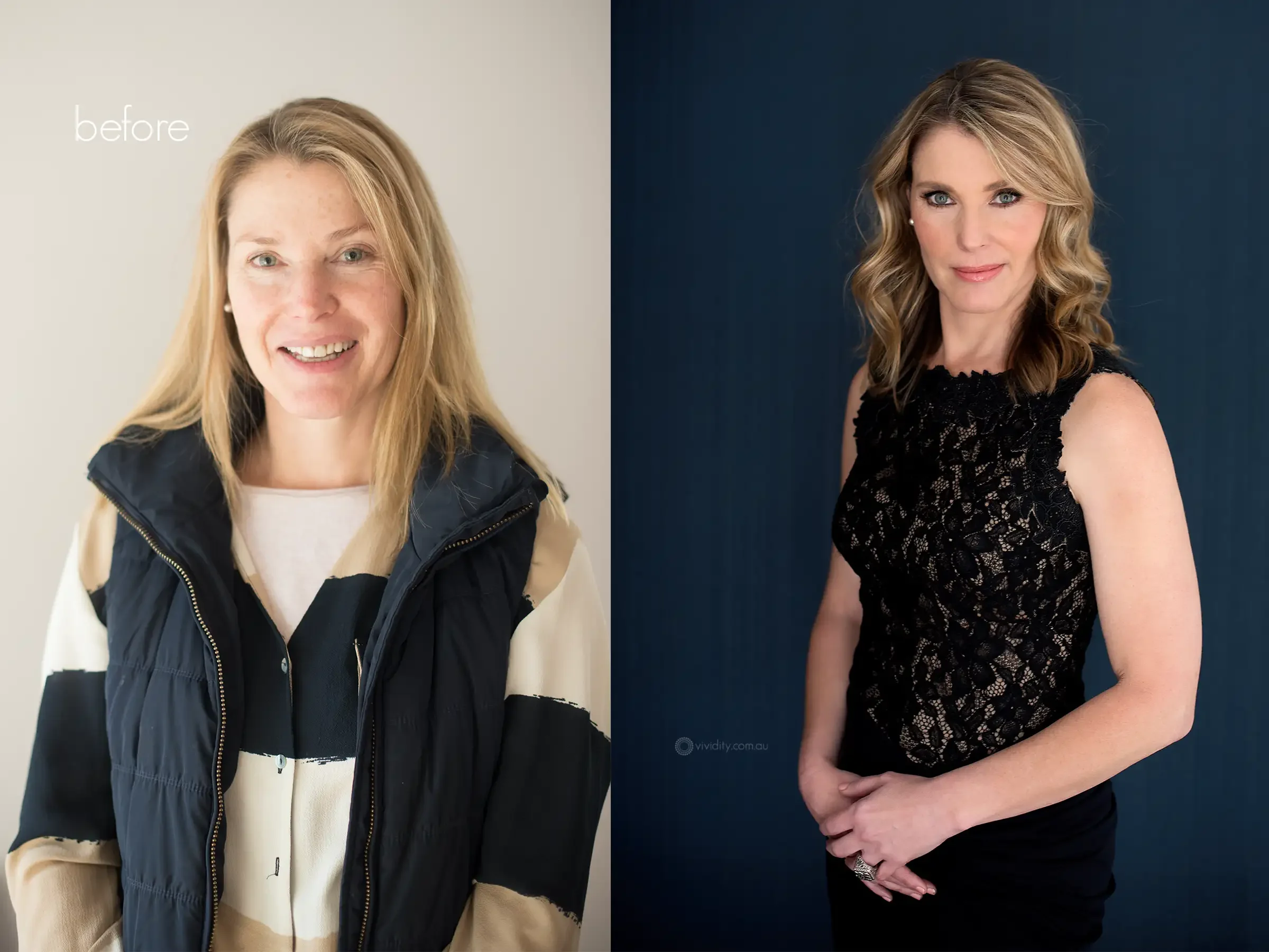 Jennifer Taylor vividity before after classy.webp