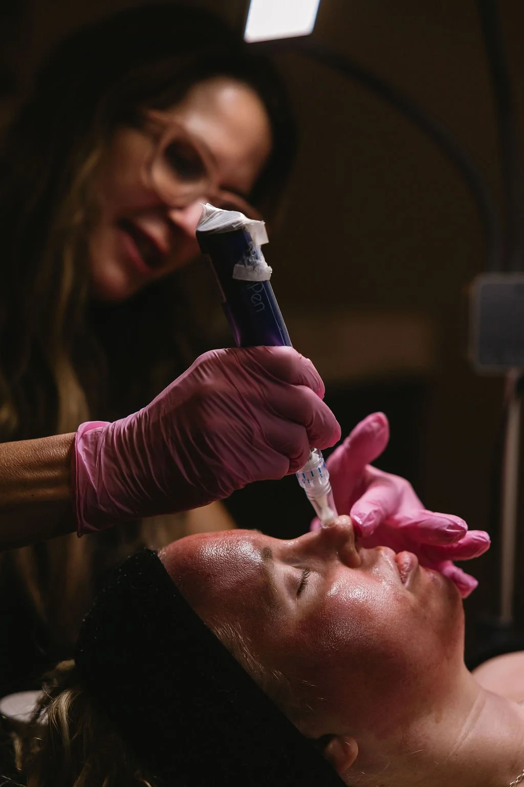 Microneedling treatment in Mineral Point WI