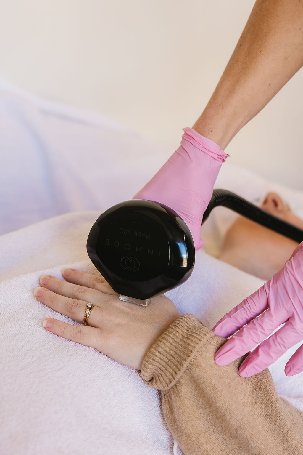 Morpheus8 skin tightening treatment