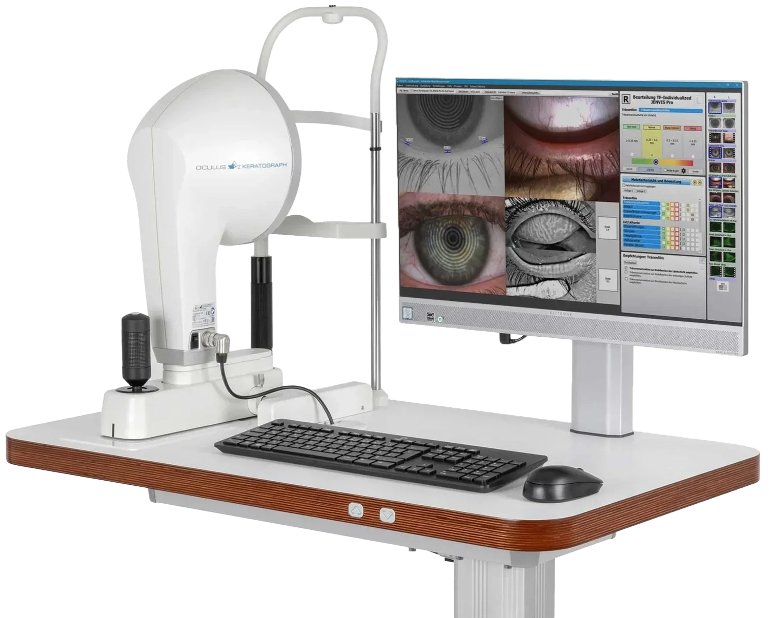 Medical eye examination equipment featuring an Oculus Keratograph device connected to a computer monitor displaying detailed eye images, including corneal topography charts and eye surface scans, on a white and wood desk.