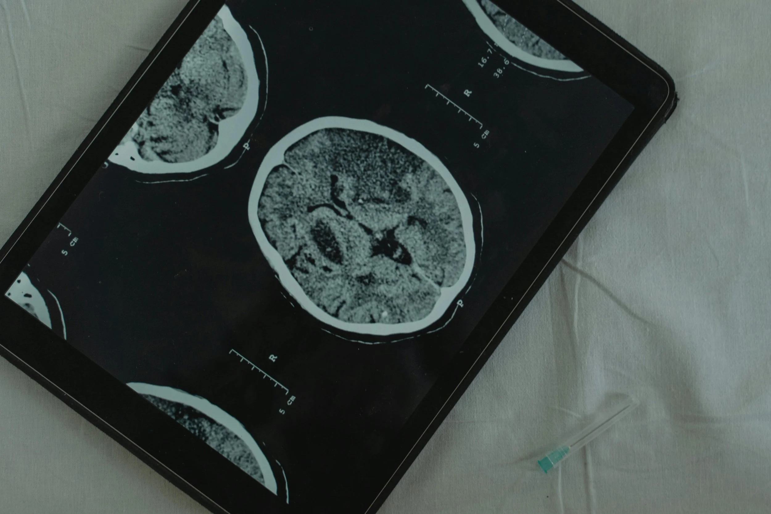Understanding Neurodivergence