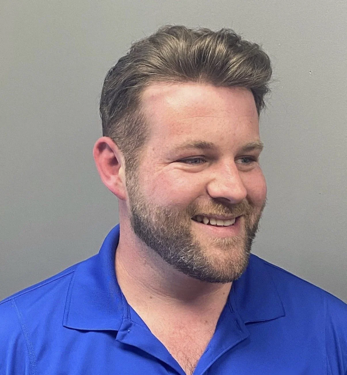 NASHVILLE HAIR REPLACEMENT - HAIR SYSTEM RESULTS 3