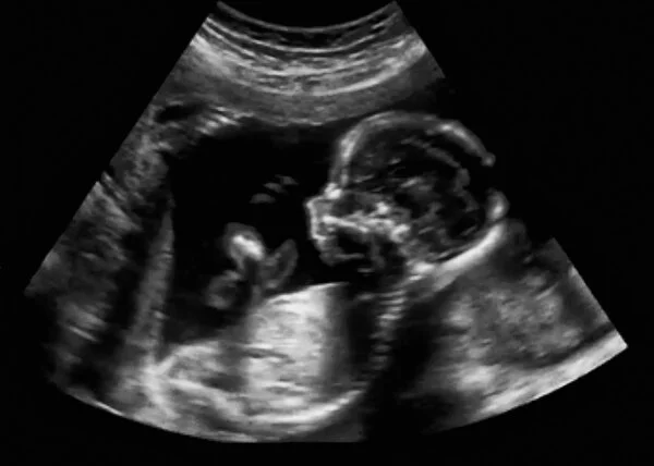 Ultrasound Packages