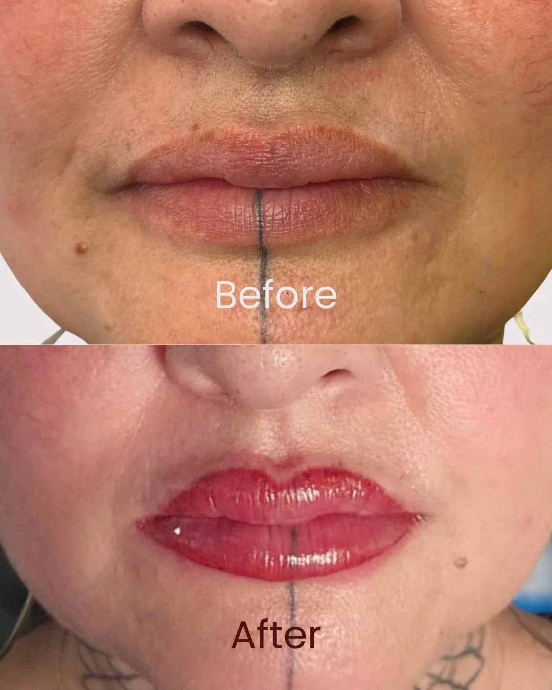 Close-up of a person's lips and surrounding skin showing a before and after of lip enhancement. The top image shows natural lips with a vertical line marking the midline, labeled 'Before.' The bottom image shows lips with shiny, red lipstick applied, labeled 'After.'
