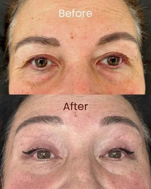 Before & After Hairstrokes PMU