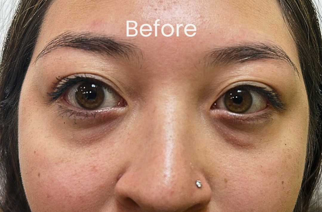 Close-up of a woman's face before her eyebrow ombre or powder treatment.