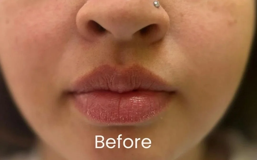 Close-up of client's lips prior to undergoing a full lip PMU treatment.