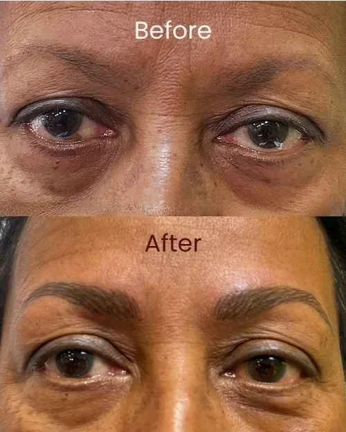 Before and after close-up photos of a woman's eyes showing PMU eyebrow enhancement, with the eyebrows appearing fuller and more defined in the after image.