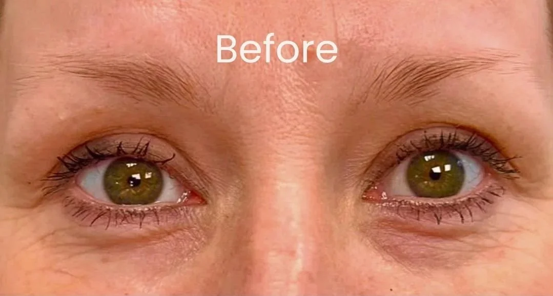 Close-up of a client's face showing her before her Nano brows treatment.